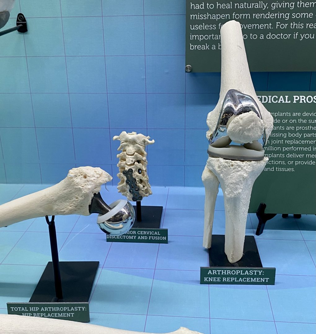 displays of real bone with knee, hip, and other medical interventions