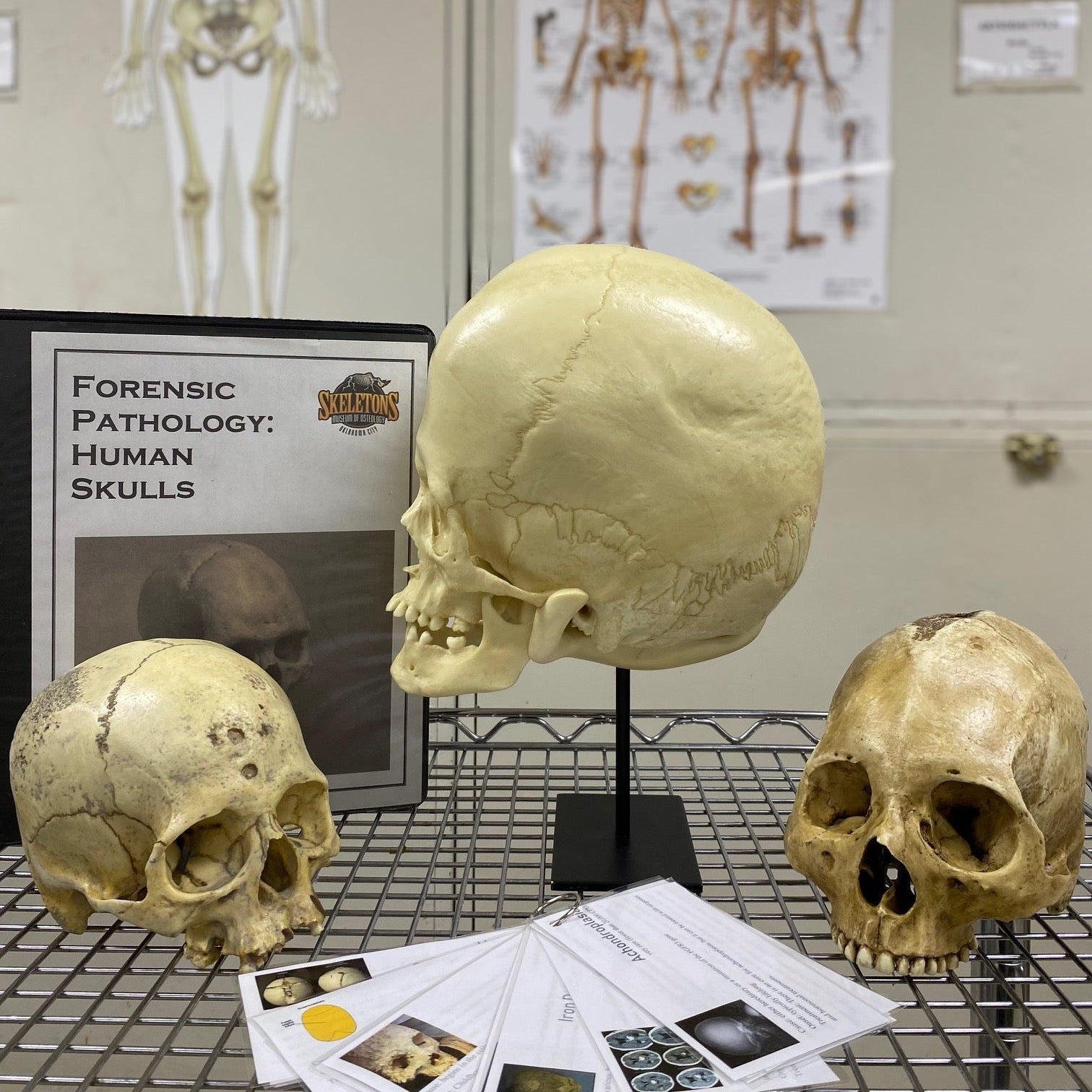 Three human skulls on display with educational materials and a skeleton model in the background.