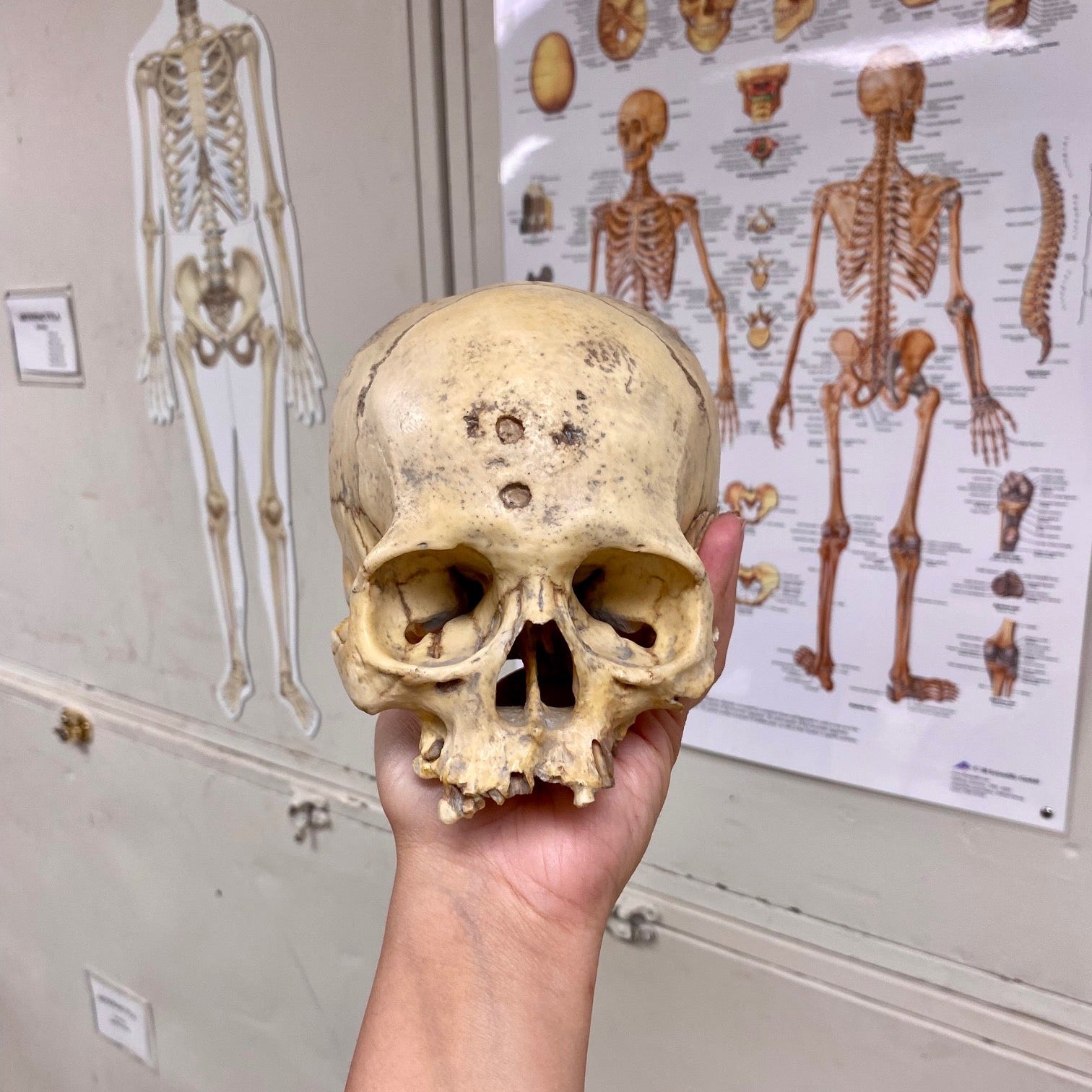Hand holding a human skull with anatomical posters in the background
