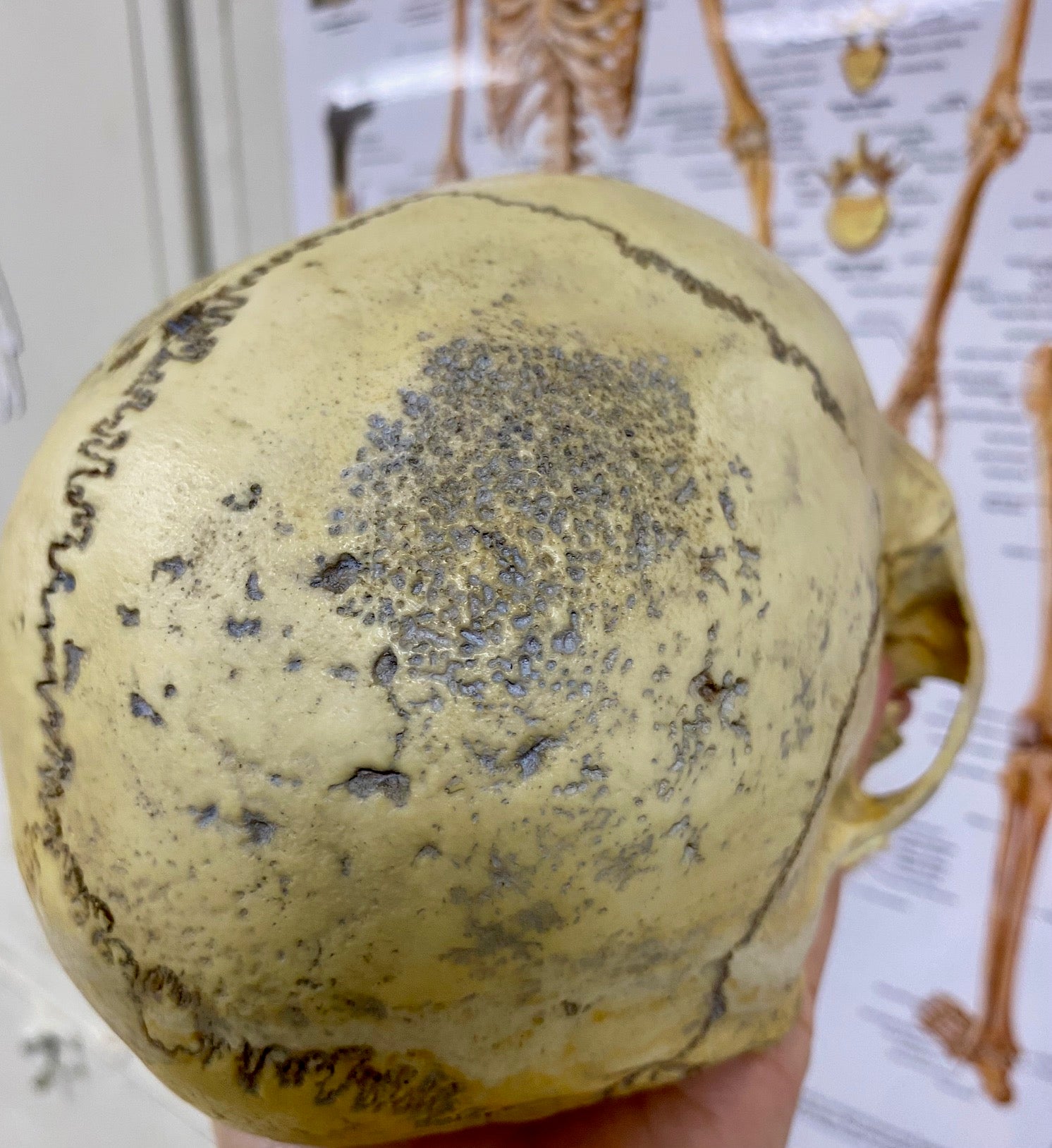 Forensic Pathology Night